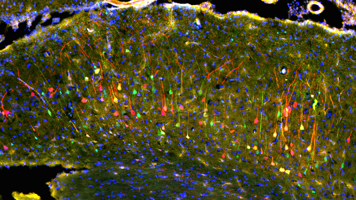 Transgene Tiermodelle