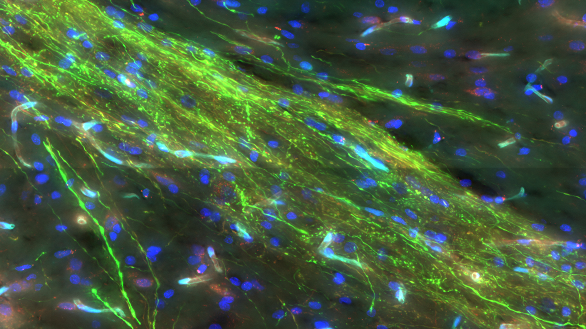 Transgene Tiermodelle