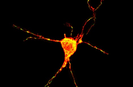 Neuron