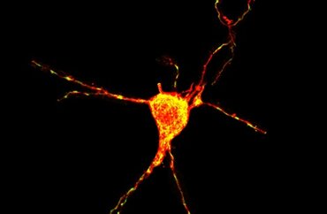 Neuron
